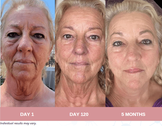 Face, Neck and Eyes Treatment