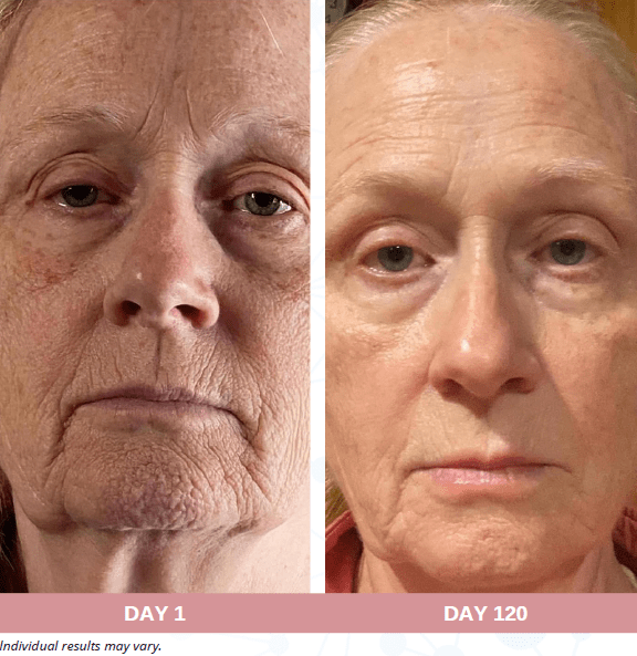 Face, Neck and Eyes Treatment