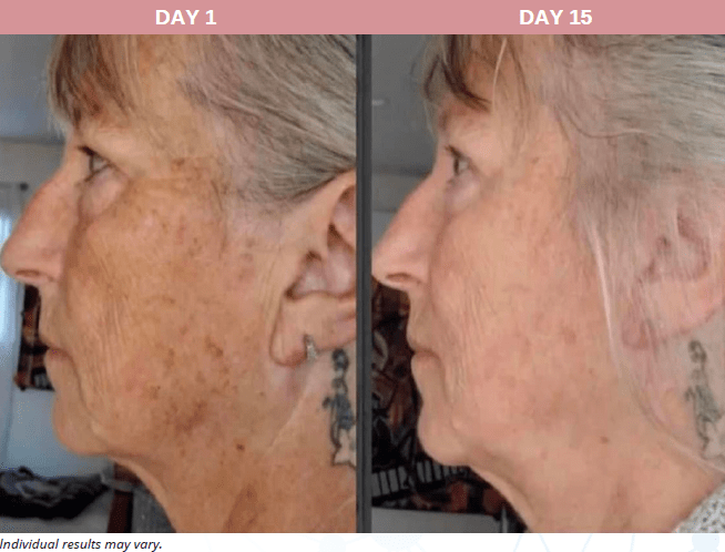 Face, Neck and Eyes Treatment