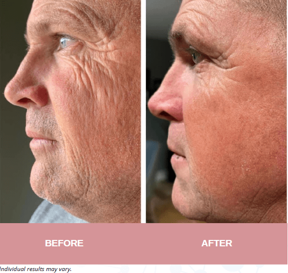 Face, Neck and Eyes Treatment