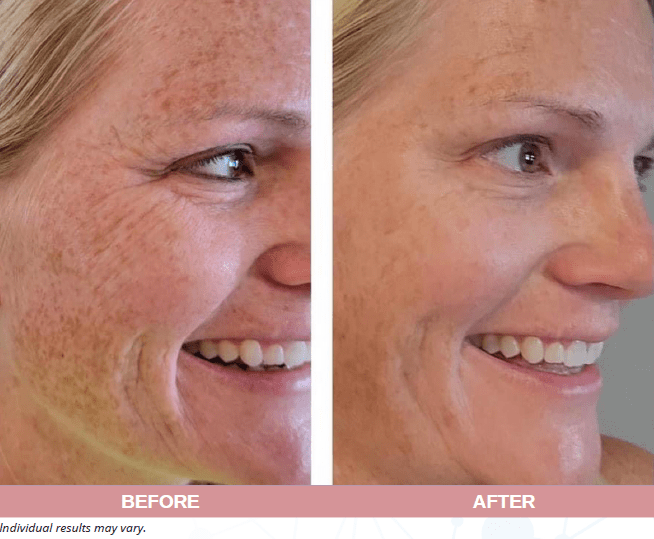 Face, Neck and Eyes Treatment
