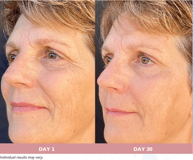 Face, Neck and Eyes Treatment