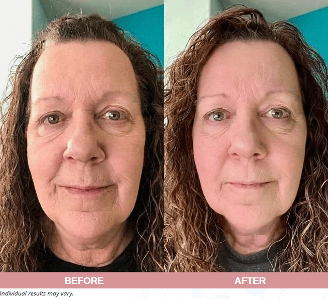 Face, Neck and Eyes Treatment