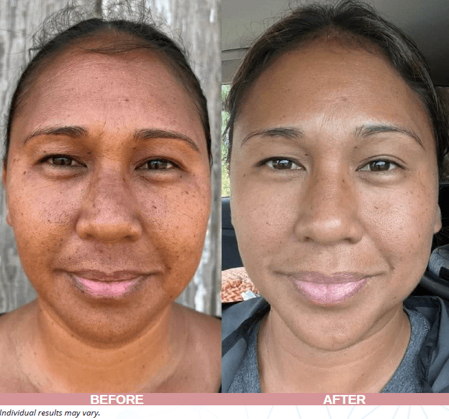 Face, Neck and Eyes Treatment