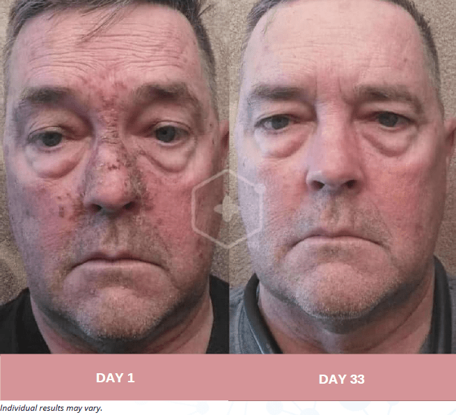 Face, Neck and Eyes Treatment