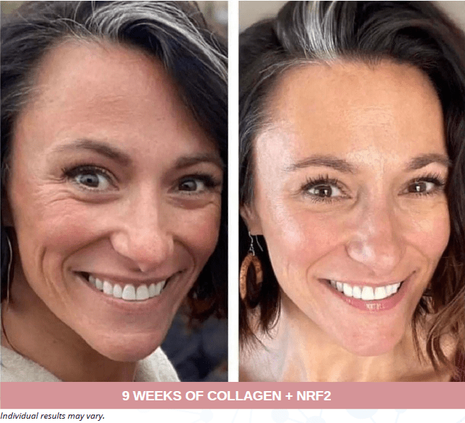 Face, Neck and Eyes Treatment