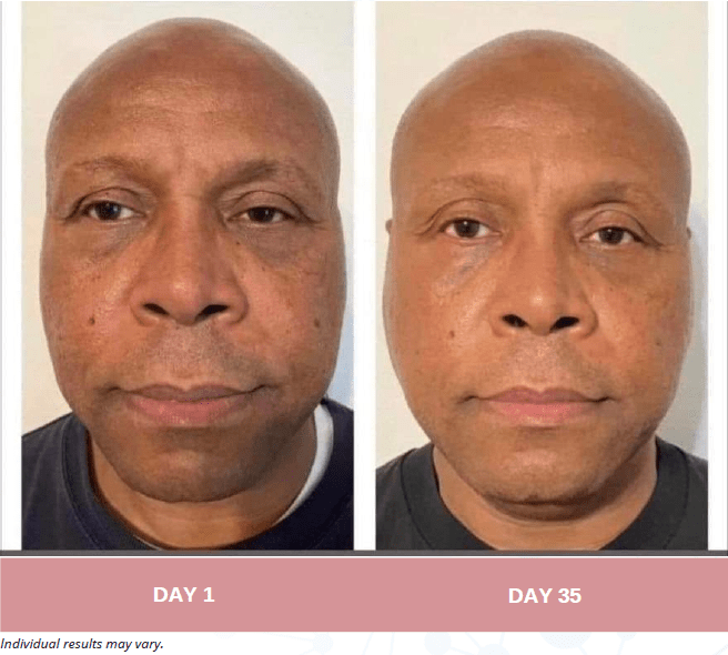 Face, Neck and Eyes Treatment